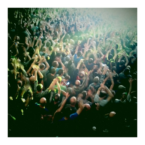 orbital-male-patterned-baldness-belfast-2013